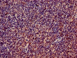 Polyclonal Rabbit anti-Human RPL4 / Ribosomal Protein L4 Antibody (IHC, IF, WB)