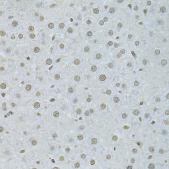 Polyclonal Rabbit anti-Human HNRNPK / hnRNP K Antibody (IHC, IF, WB)