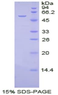 Human NTN1 / Netrin 1 Protein (Recombinant His, N-Terminal)