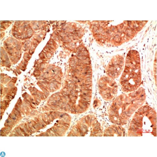TP53 / p53 Antibody