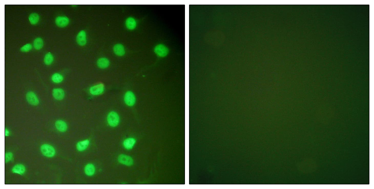 PathPlus™ Polyclonal Rabbit anti-Human MCM2 Antibody (aa1-50, IHC, IF, WB)