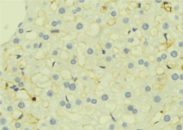 TGFBI Antibody
