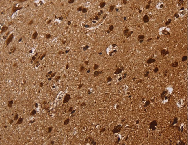 KARS Antibody