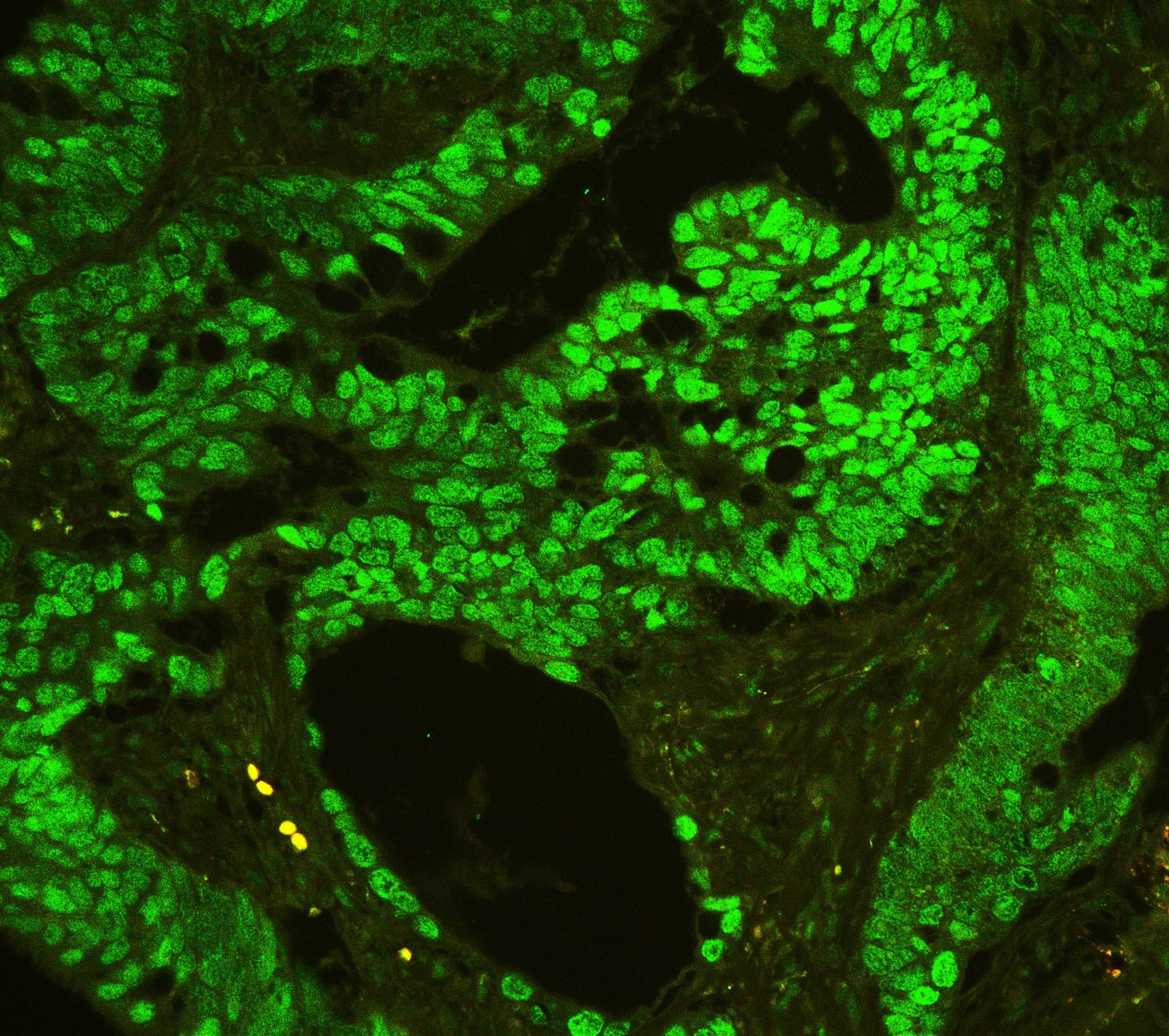 CTBP2 Antibody (aa321-445)
