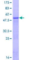 Human CIDEB Protein (Recombinant GST)