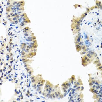 ARSF / Arylsulfatase F Antibody