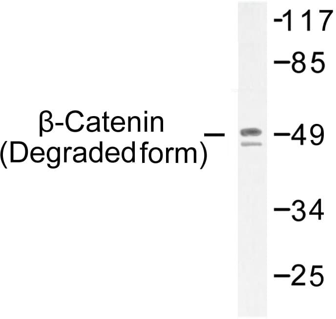 CTNNB1 / Beta Catenin Antibody (phospho-Thr41)