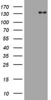 Monoclonal Mouse anti-Human ZEB2 / SIP-1 Antibody (clone OTI4D12, aa1-350, WB)