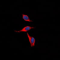 Polyclonal Rabbit anti-Human PTGIR / IP Receptor Antibody (Internal, IF, WB)