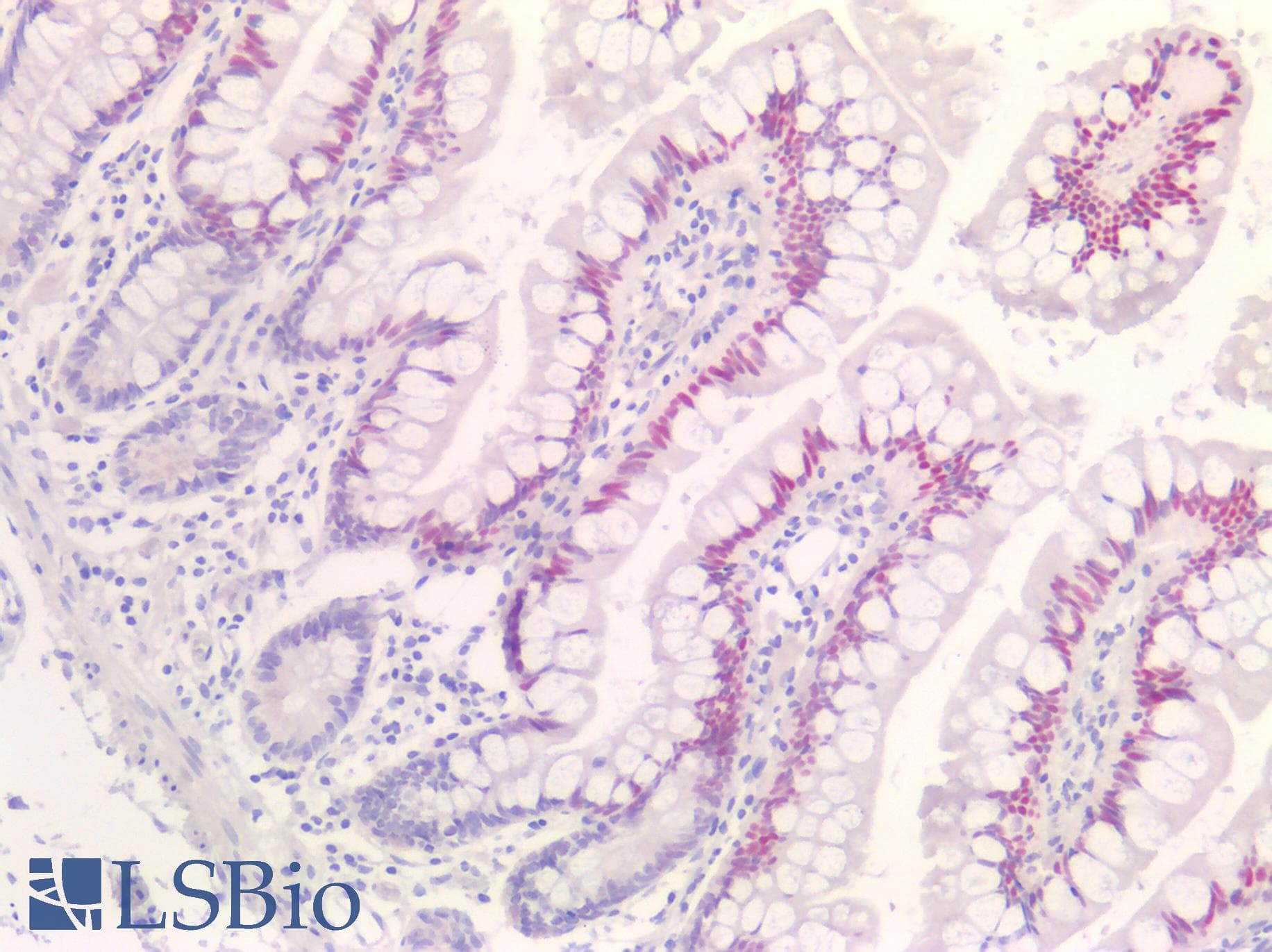 PathPlus™ CDKN1A / WAF1 / p21 Antibody
