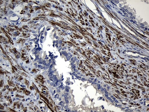 Monoclonal Mouse anti-Human FLJ33360 Antibody (clone OTI10B12, Carrier-free, IHC, WB)