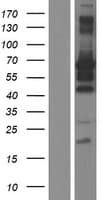 MEIS2 Protein (Over-Expression Lysate Myc-DDK (Flag))