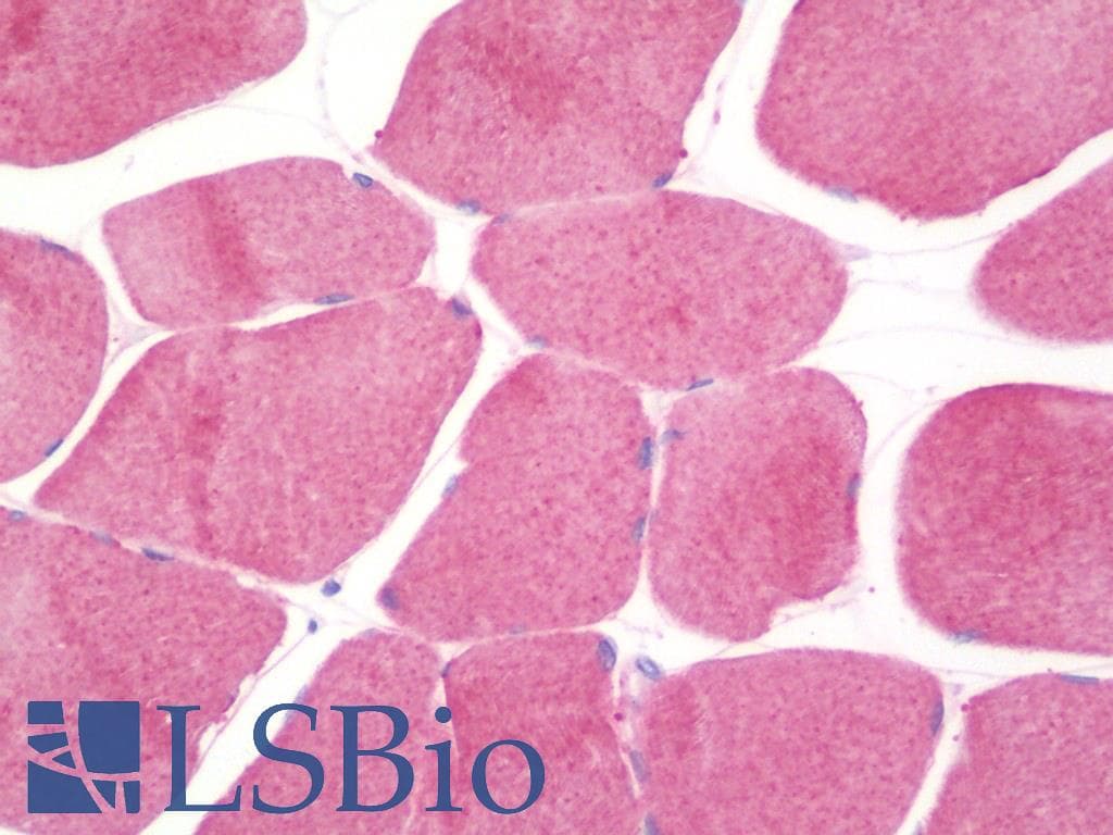 IHC-plus™ HSPB8 / H11 / HSP22 Antibody (aa134-196)