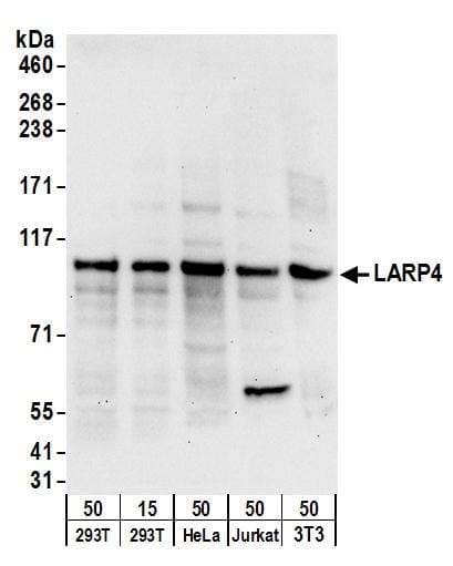 IHC-plus™ Polyclonal Rabbit anti-Human CD44 Antibody (aa692-742, IHC, WB)