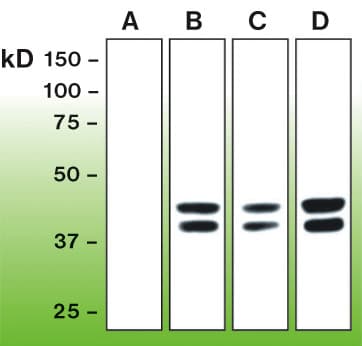 MAPK1 / ERK2 Antibody (phospho-Thr180/Tyr182)
