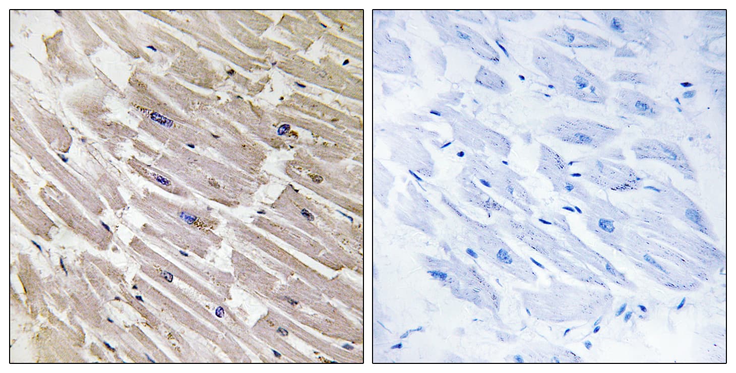 MRPL16 Antibody (aa171-220)