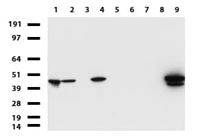 KRT19 / CK19 / Cytokeratin 19 Antibody (aa240-390, clone UMAB187, Carrier-free)