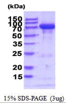 Mouse TGM2 / Transglutaminase 2 Protein (Recombinant 6His, N-terminus)
