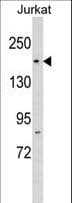 RPAP1 Antibody (aa282-310)
