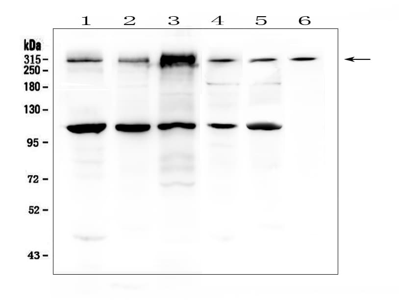 IGF2R / CD222 Antibody