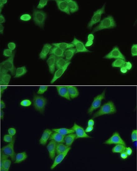 SLC2A9 / GLUT9 Antibody