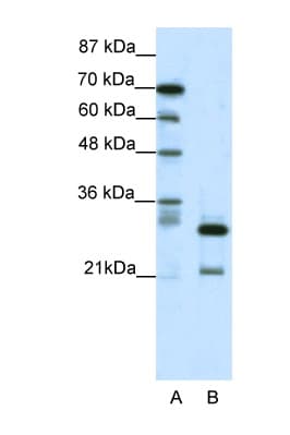 Polyclonal Rabbit anti-Human HMOX2 / Heme Oxygenase 2 Antibody (N-Terminus, IHC, WB)