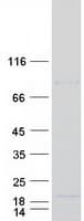 Human AP2S1 Protein (Recombinant Myc-DDK (Flag))