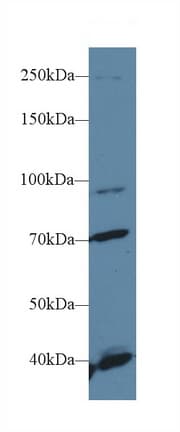 FGFR2 / FGF Receptor 2 Antibody (aa157-377)