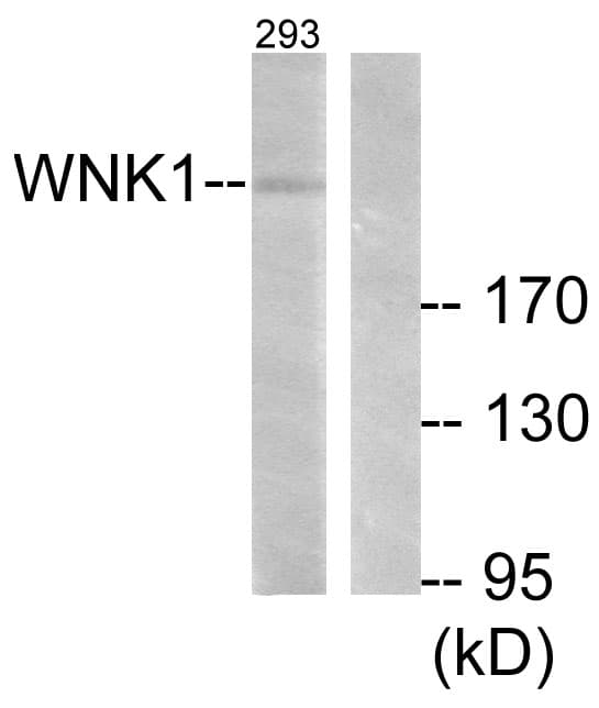 Polyclonal Rabbit anti-Human WNK1 Antibody (aa24-73, IHC, WB)