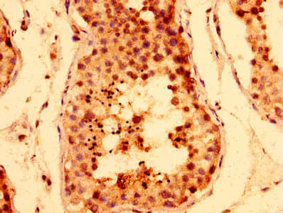 TNKS / Tankyrase Antibody