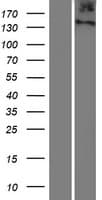 ITIH6 / ITIH5L Protein (Over-Expression Lysate Myc-DDK (Flag))