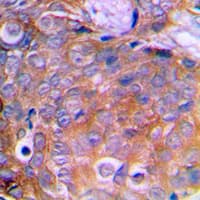 CTTN / Cortactin Antibody (C-Terminus)