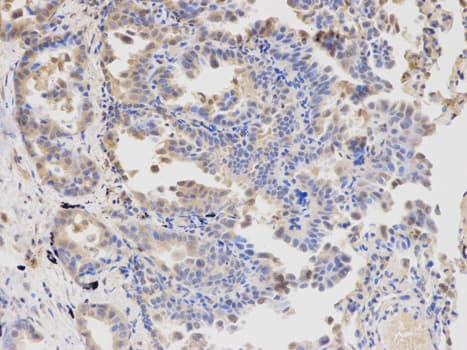 APBB1 / FE65 Antibody