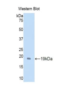 GDNF Antibody (aa79-217)