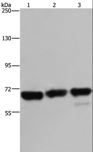 Polyclonal Rabbit anti-Human PCK2 / PEPCK Antibody (IHC, WB)