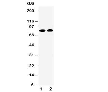 Polyclonal Rabbit anti-Human CAPN1 / Calpain 1 Antibody (aa313-327, IHC, WB)