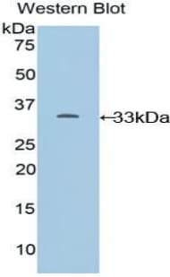 CYP24 / CYP24A1 Antibody (aa260-514)