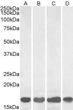 IHC-plus™ Polyclonal Goat anti-Human AIF1 / IBA1 Antibody (aa149-161, IHC, WB)