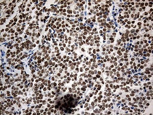 ASH2L / ASH2 Antibody (aa347-628, clone OTI10D8)