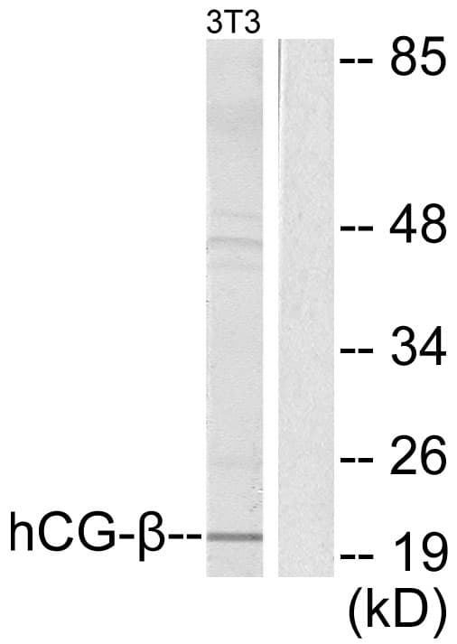 IHC-plus™ CGB / hCG Beta Antibody (aa101-150)
