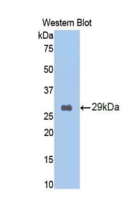 LGALS9 / Galectin 9 Antibody (aa194-322, FITC)
