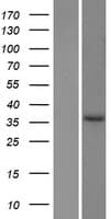 EPDR / EPDR1 Protein (Over-Expression Lysate Myc-DDK (Flag))