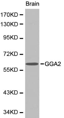 Polyclonal Rabbit anti-Human GGA2 Antibody (IHC, WB)