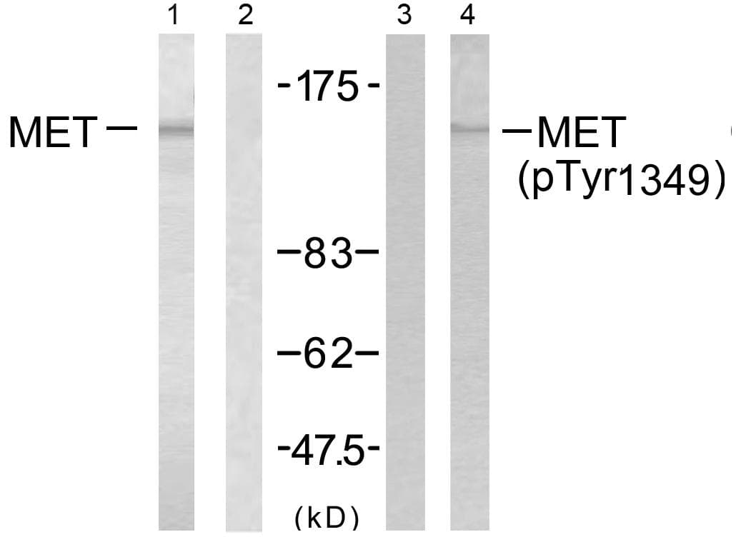 c-Met Antibody (p1349)