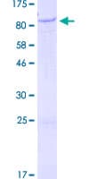 Human IGFALS / ALS Protein (Recombinant GST)