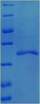 Chicken TGFB1 / TGF Beta 1 Protein (Recombinant 6His-SUMO, N-terminus)