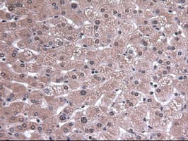 Monoclonal Mouse anti-Human EPCAM Antibody (clone OTI2C8, IHC, WB)