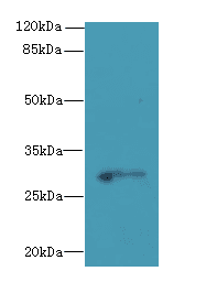 C1QTNF6 / CTRP6 Antibody
