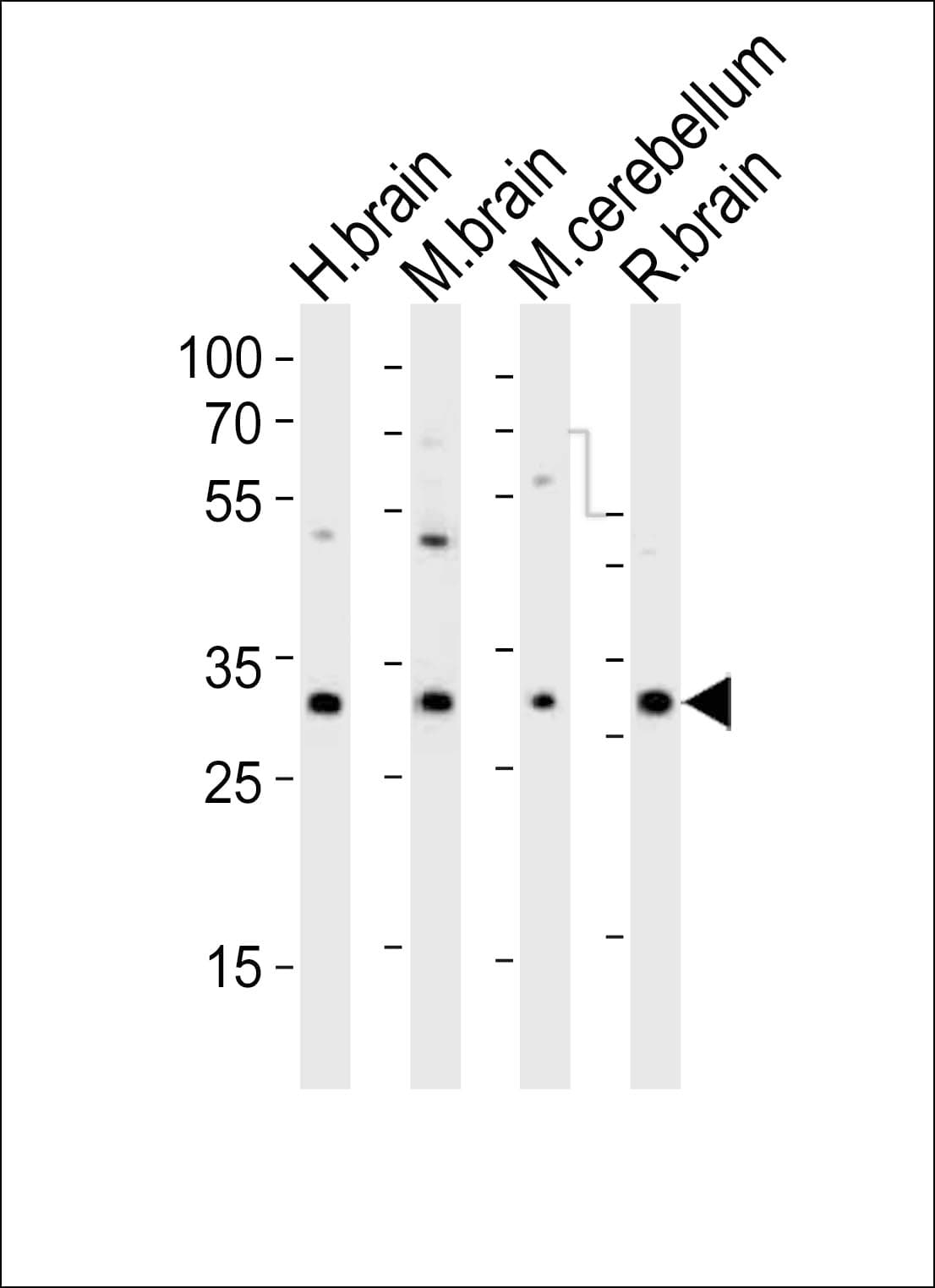 Polyclonal Rabbit anti-Human NSPC1 / PCGF1 Antibody (aa117-151, WB)