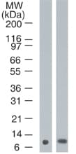 IHC-plus™ Monoclonal Mouse anti-Human S100A7 / Psoriasin Antibody (clone 47C1068, IHC, WB)